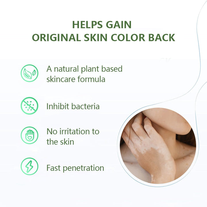 White Tag Treatment Moisturizing Cream