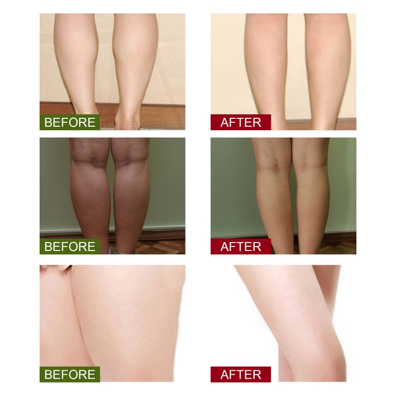 Lympatic Drainage Ginger Foot Soak