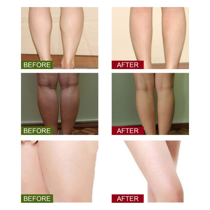 Lympatic Drainage Ginger Foot Soak